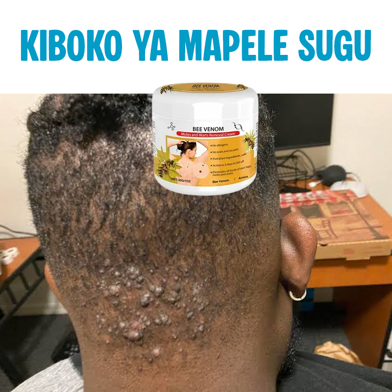 Warts Removal Cream