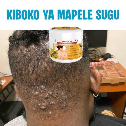 Warts Removal Cream